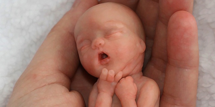 12WeekOldBaby - سقط جنین نارس، مجاز است؟