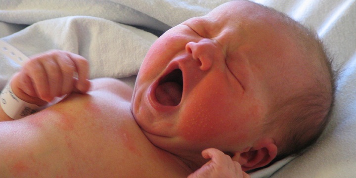 خواب نوزاد نارس، علت - اختلال خواب نوزاد نارس، علت