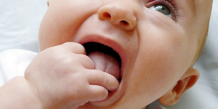تولد نوزاد با دندان